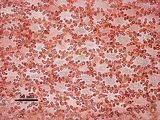 4 - Cellule corticali in visione  superficiale
